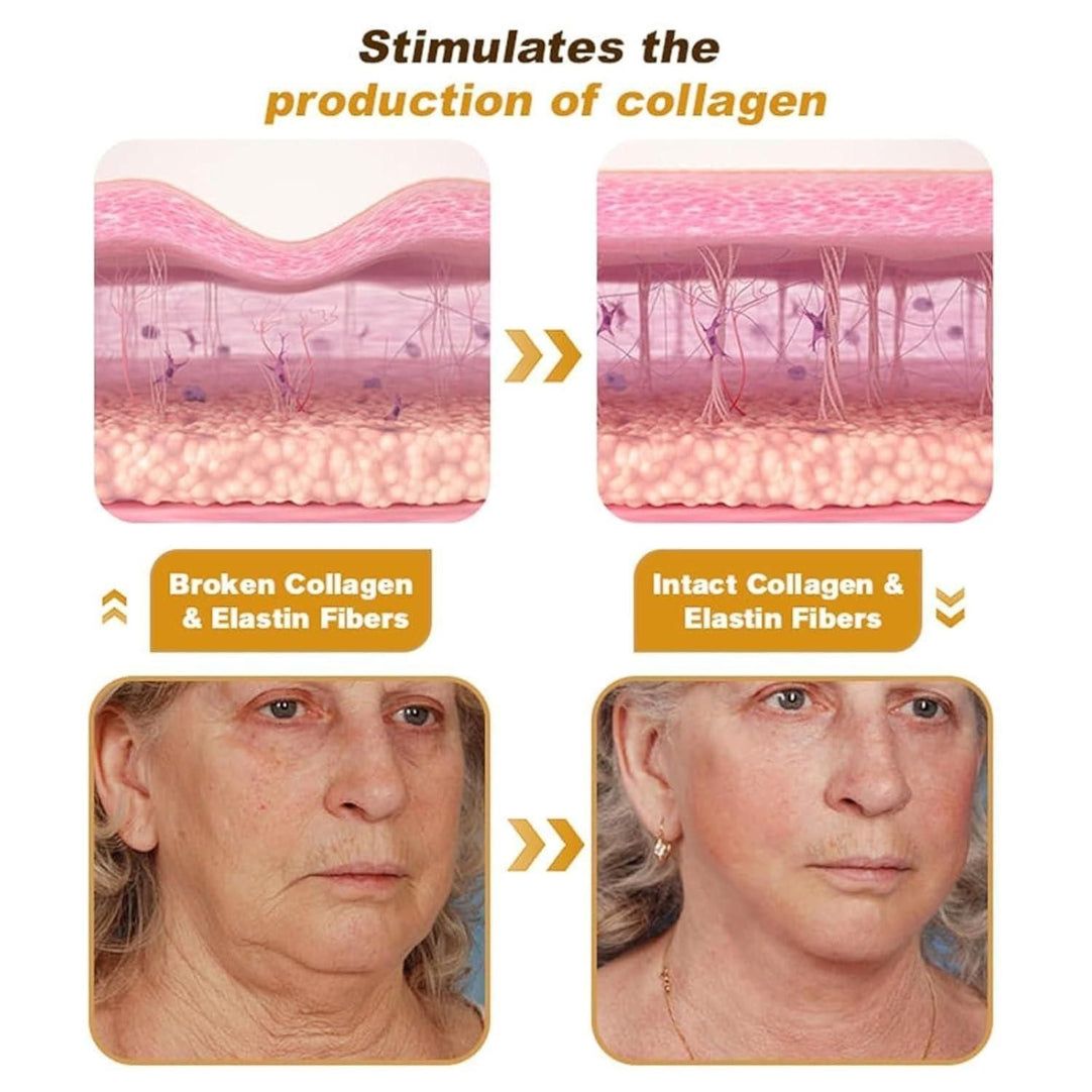 Illustration of skin with broken and intact collagen and elastin fibers, showing before and after effects.