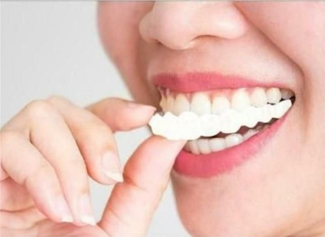 A person is shown smiling while wearing a temporary teeth braces cover which is white and seems to fit over the upper row of teeth.