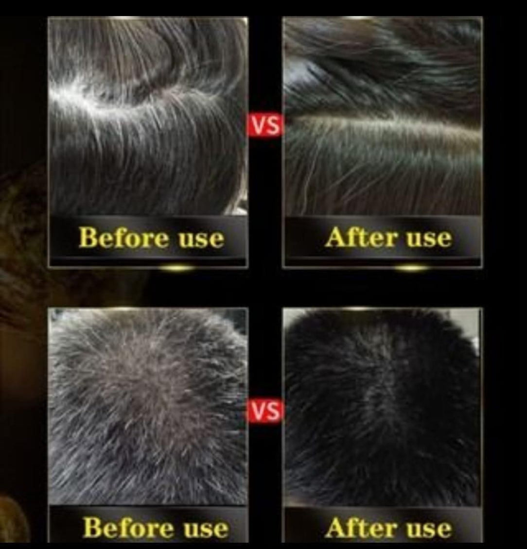Before and after hair treatment comparison showing scalp and hair health improvement.