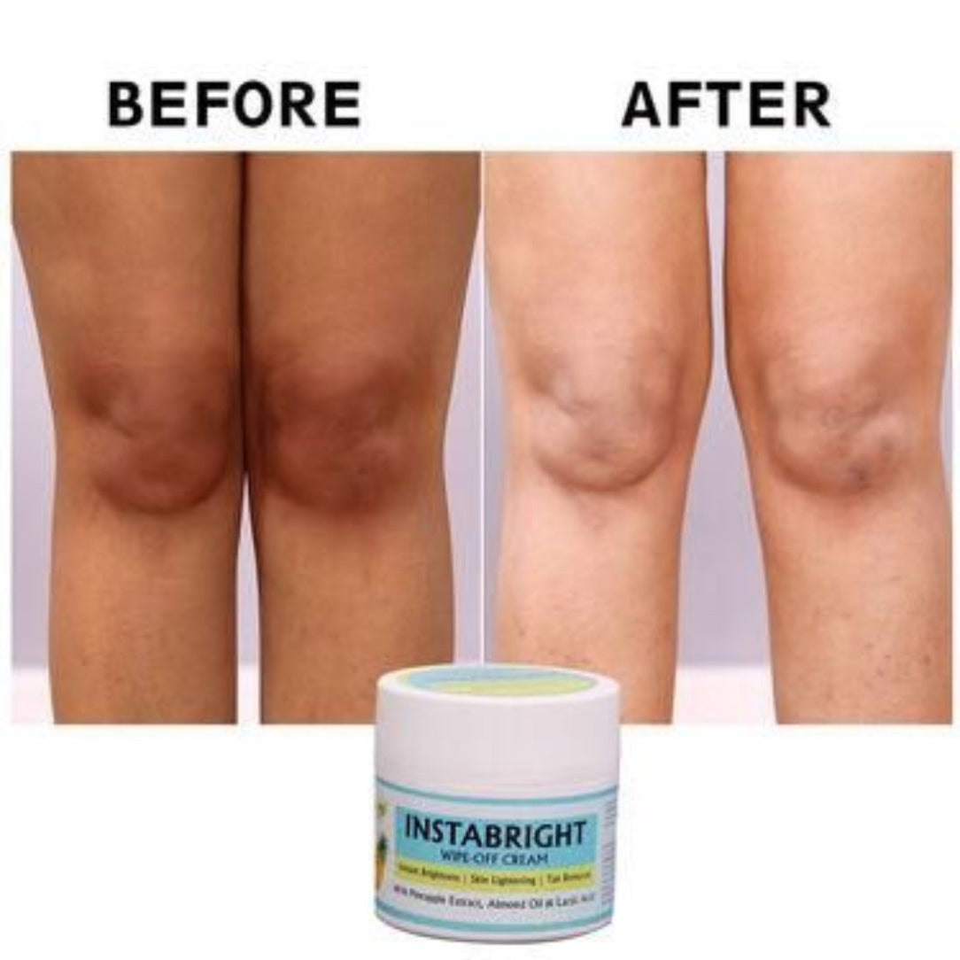 Before and after comparison of knees with a jar of Instabright cream.