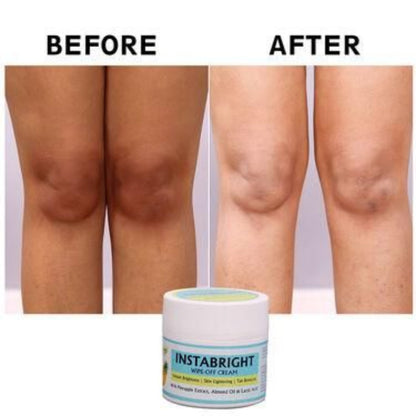 Before and after comparison of knees with a jar of Instabright cream.