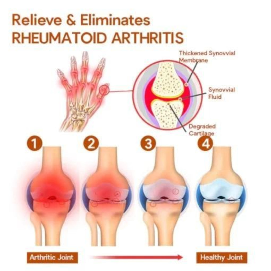 Meniscus Pain Relief Cream Buy One Get One Free)- 50g