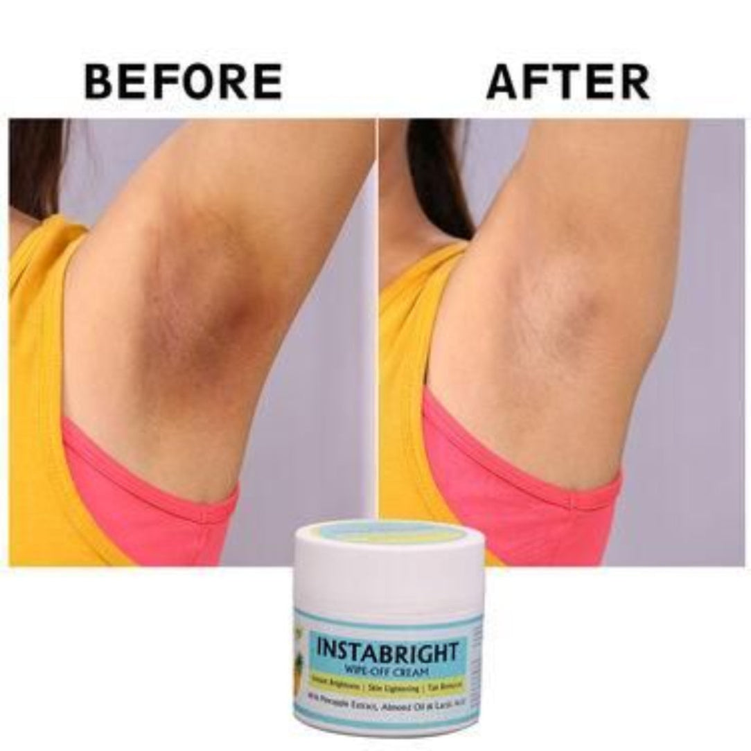 Before and after comparison of armpit hair removal with Instabright cream.