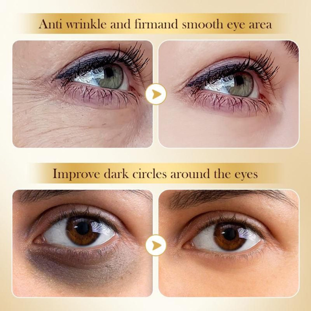 Before and after comparison of eye area treatment with text indicating anti-wrinkle, firming, and dark circle improvement.