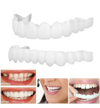 White dental aligners with before and after smile images on a white background