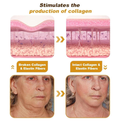 Illustration of skin with broken and intact collagen and elastin fibers, showing before and after effects.