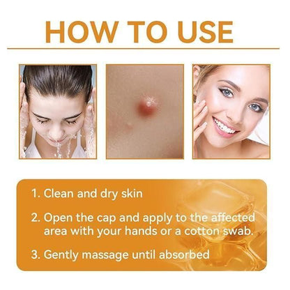 Instructions on how to use a skincare product with images of a woman washing her face, a pimple, and a woman with clear skin.