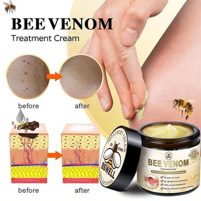 Bee Venom Treatment Cream packaging with before and after effects on skin, BSwell brand visible