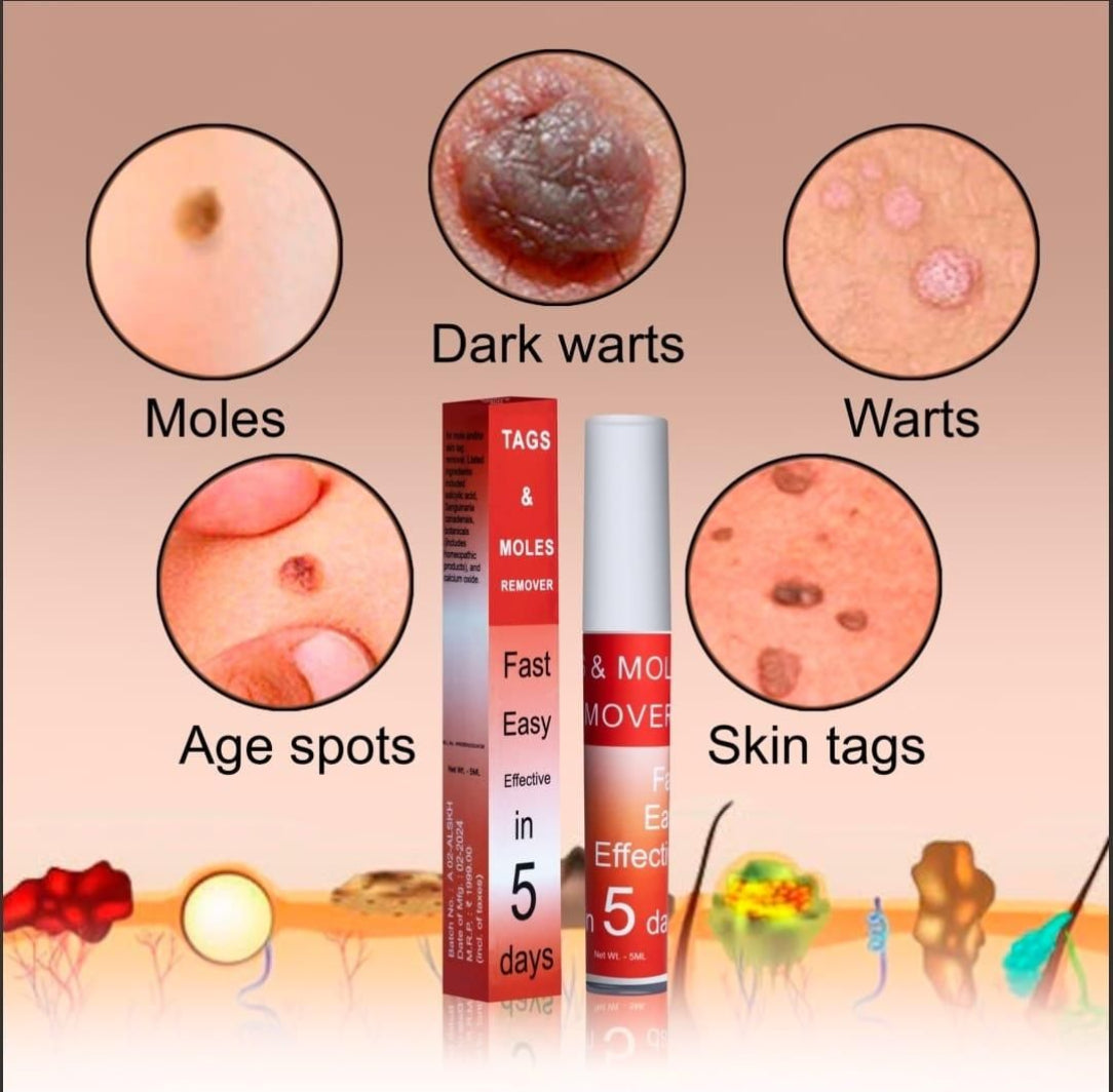 Product advertisement for moles, dark warts, warts, age spots, and skin tags removal with images and text.