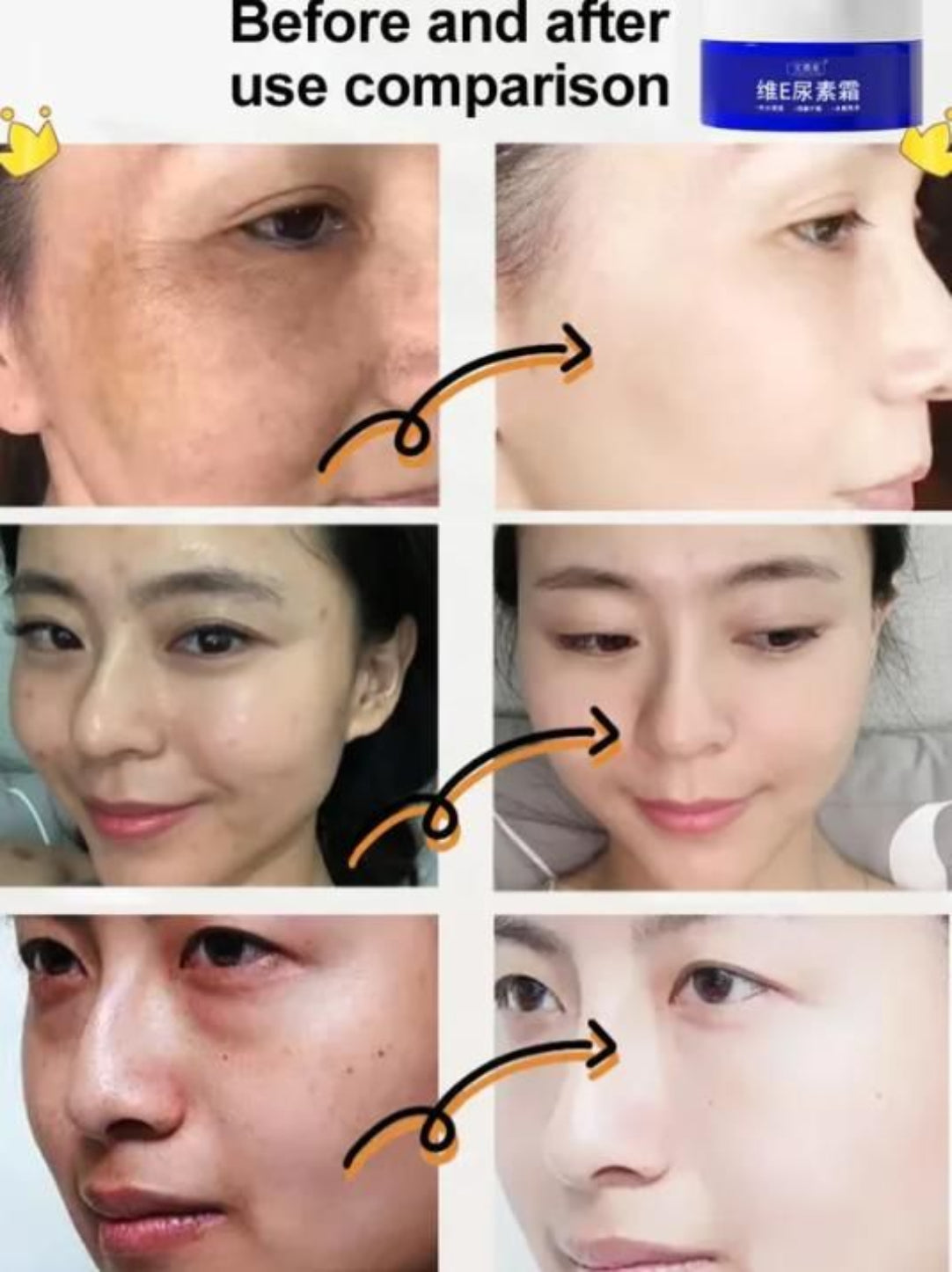 Before and after use comparison of facial skin treatment with a brand logo.