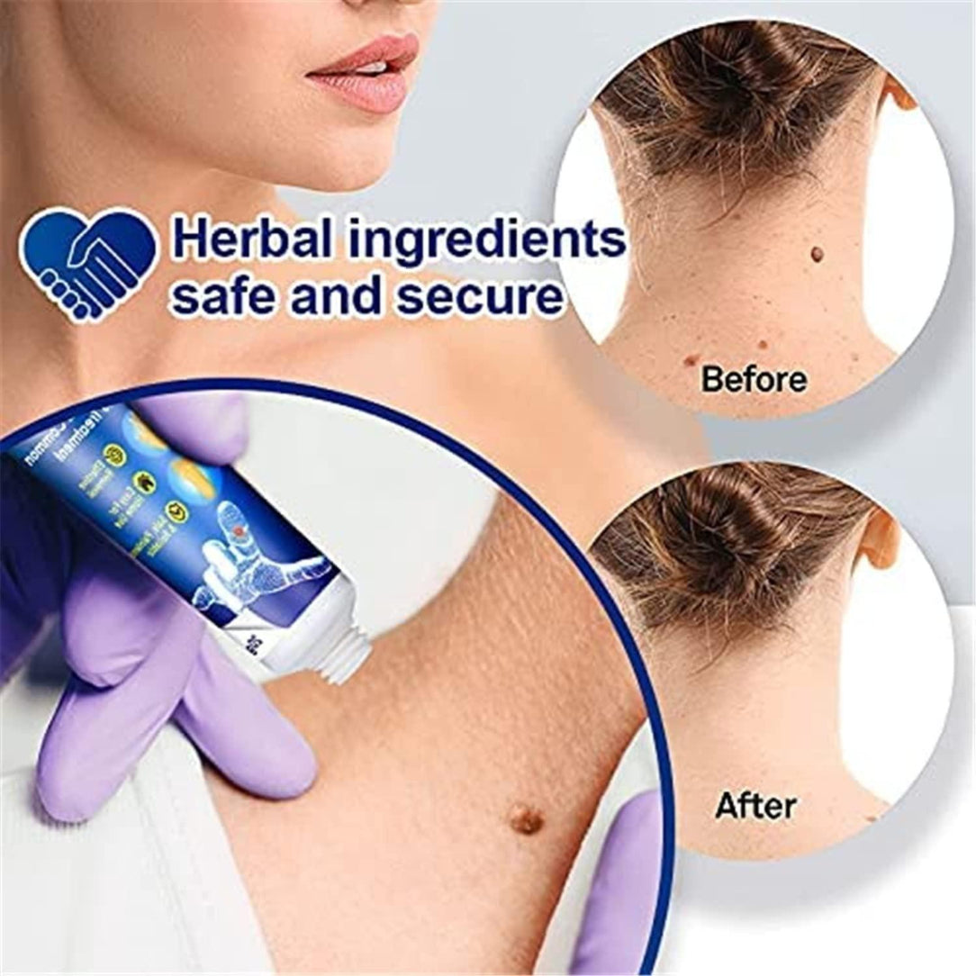 Product packaging with application on skin, 'Before' and 'After' skin condition images, and text about herbal ingredients.