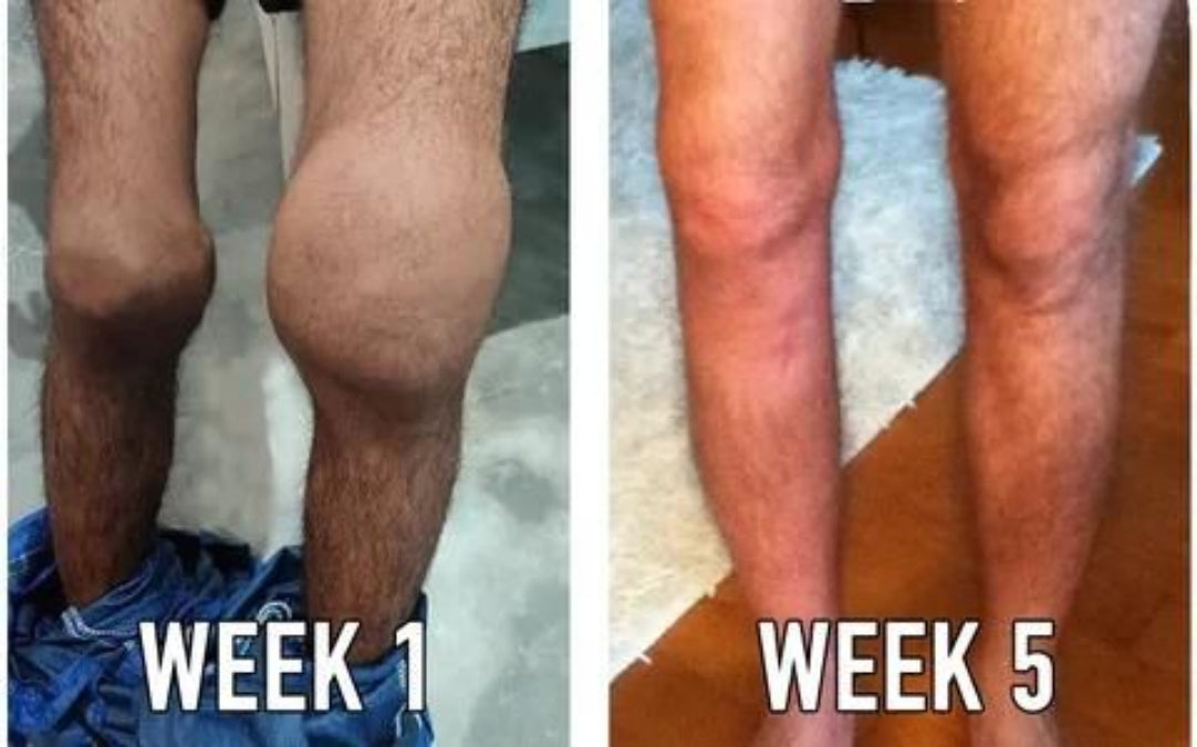 Meniscus Pain Relief Cream Buy One Get One Free)- 50g