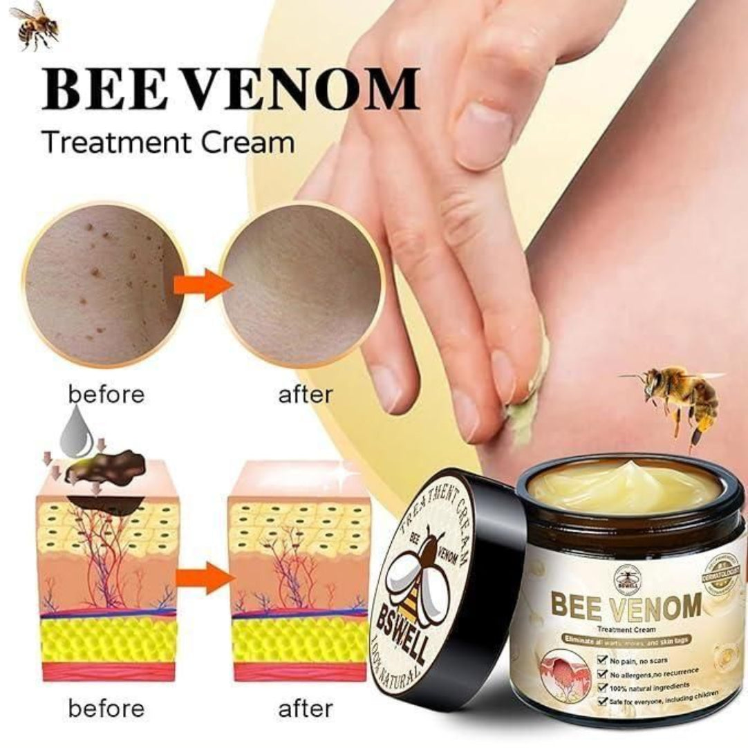 Bee Venom Treatment Cream packaging with before and after effects on skin