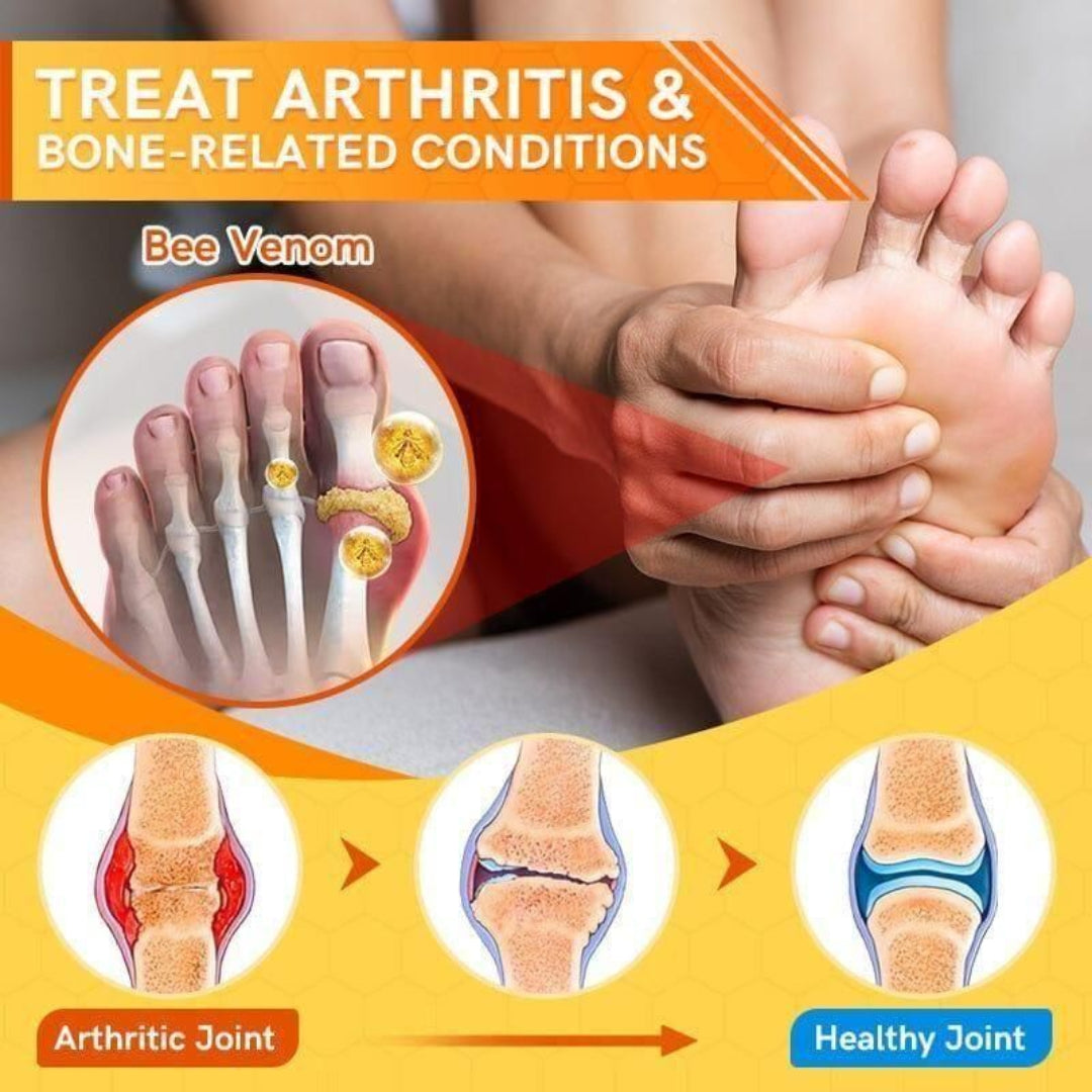 Advertisement for treating arthritis and bone-related conditions using bee venom, showing a person holding a foot with symptoms and illustrations of joint health.