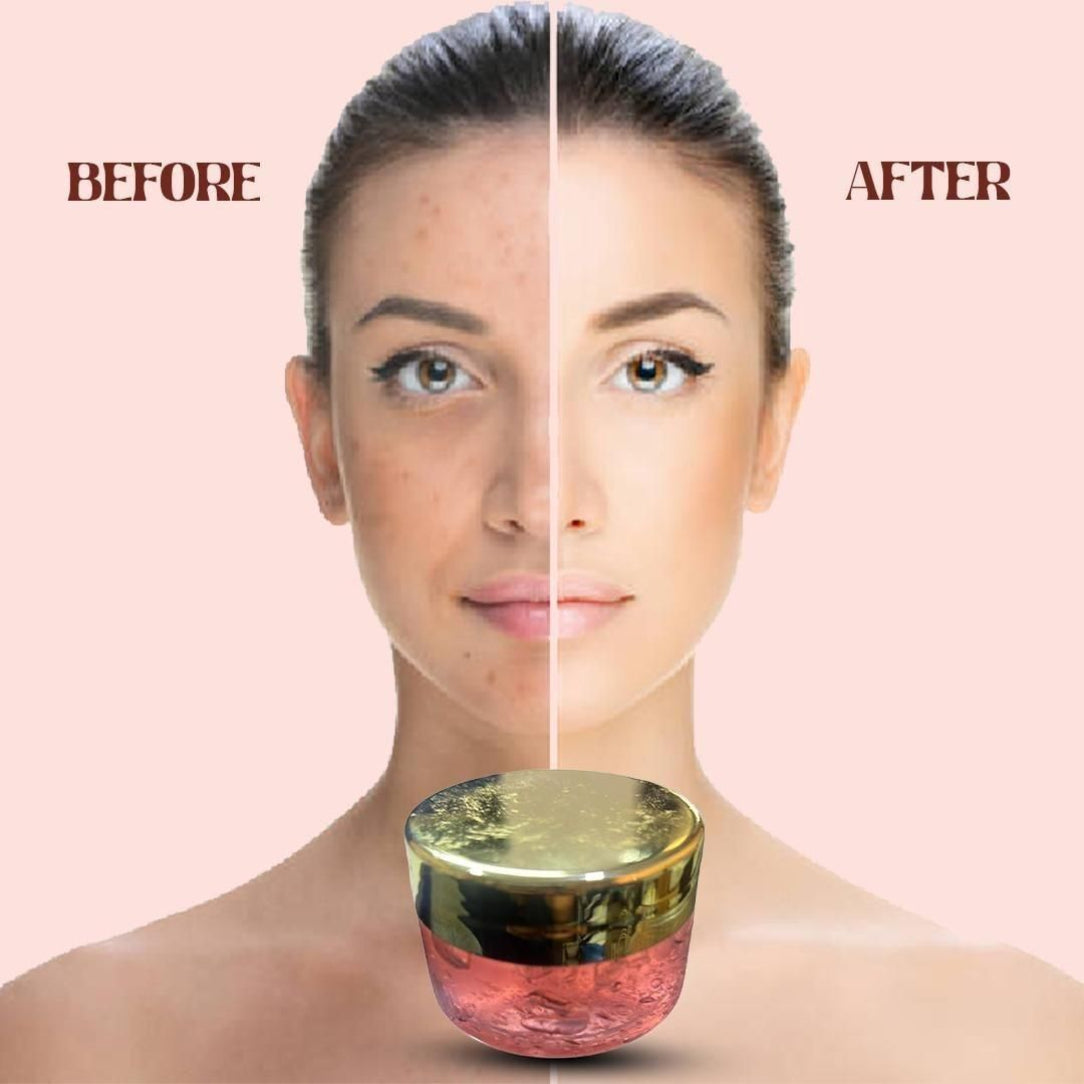 Before and after comparison of a woman's face with a jar of skincare product.