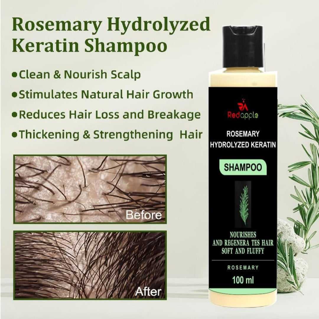 Rosemary Hydrolyzed Keratin Shampoo bottle with before and after images on a white background