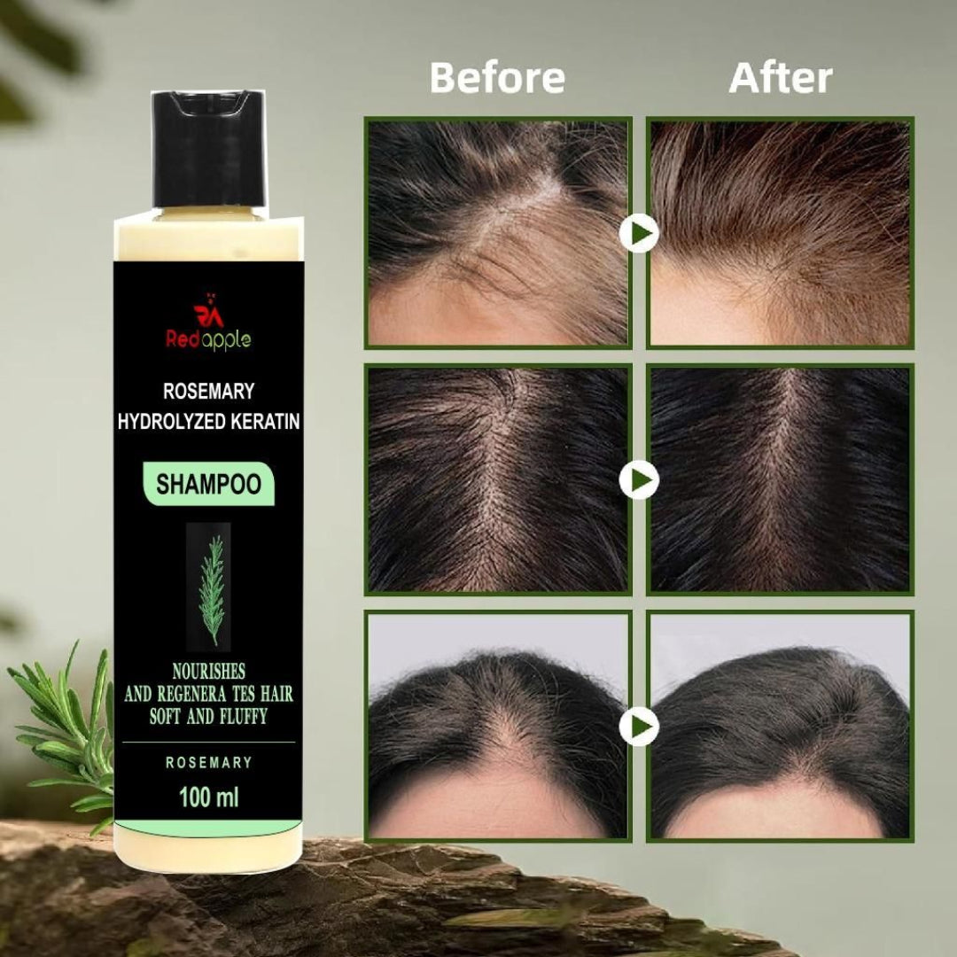 Shampoo bottle with 'Red Apple' branding and before-and-after hair growth results.